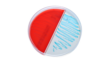 Blood agar catagory