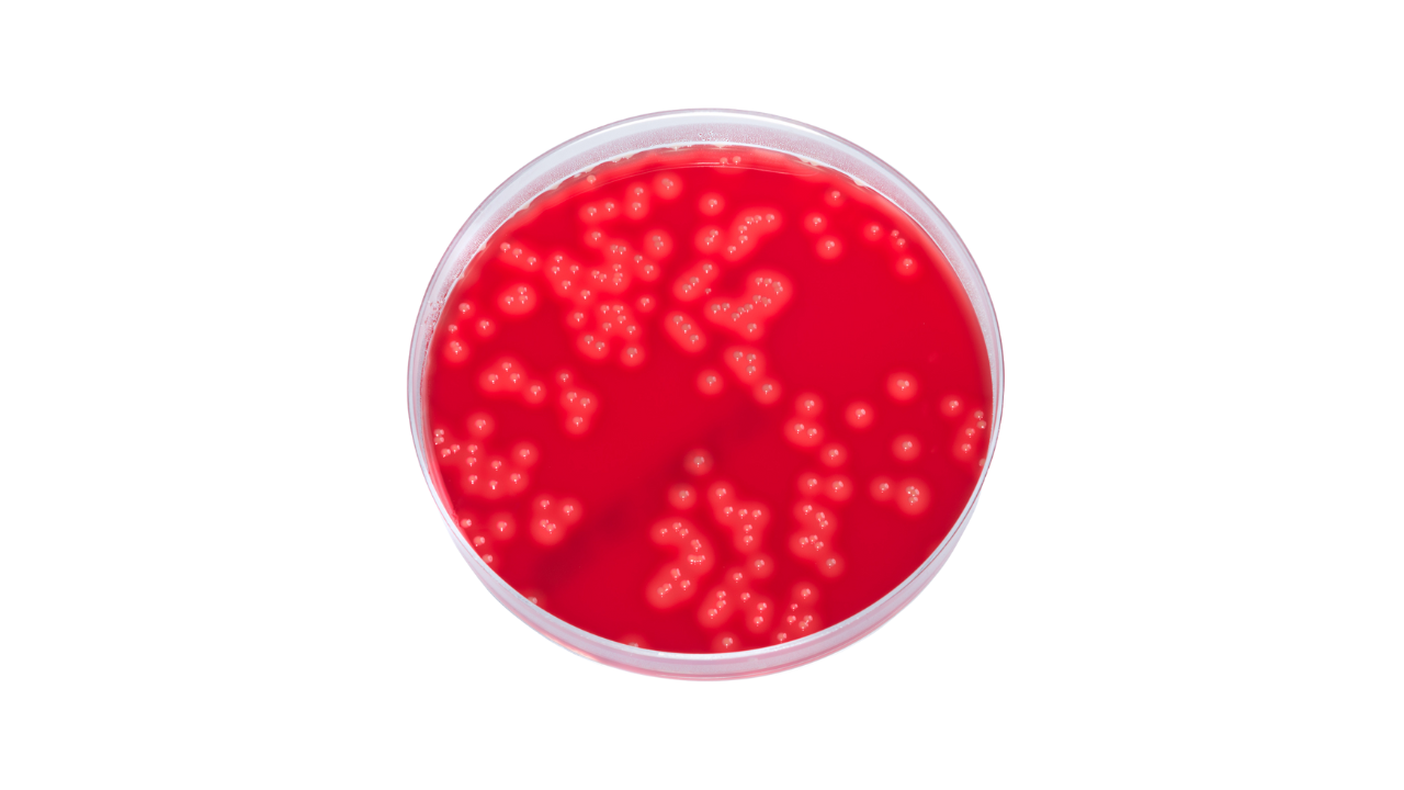 Blood agar line