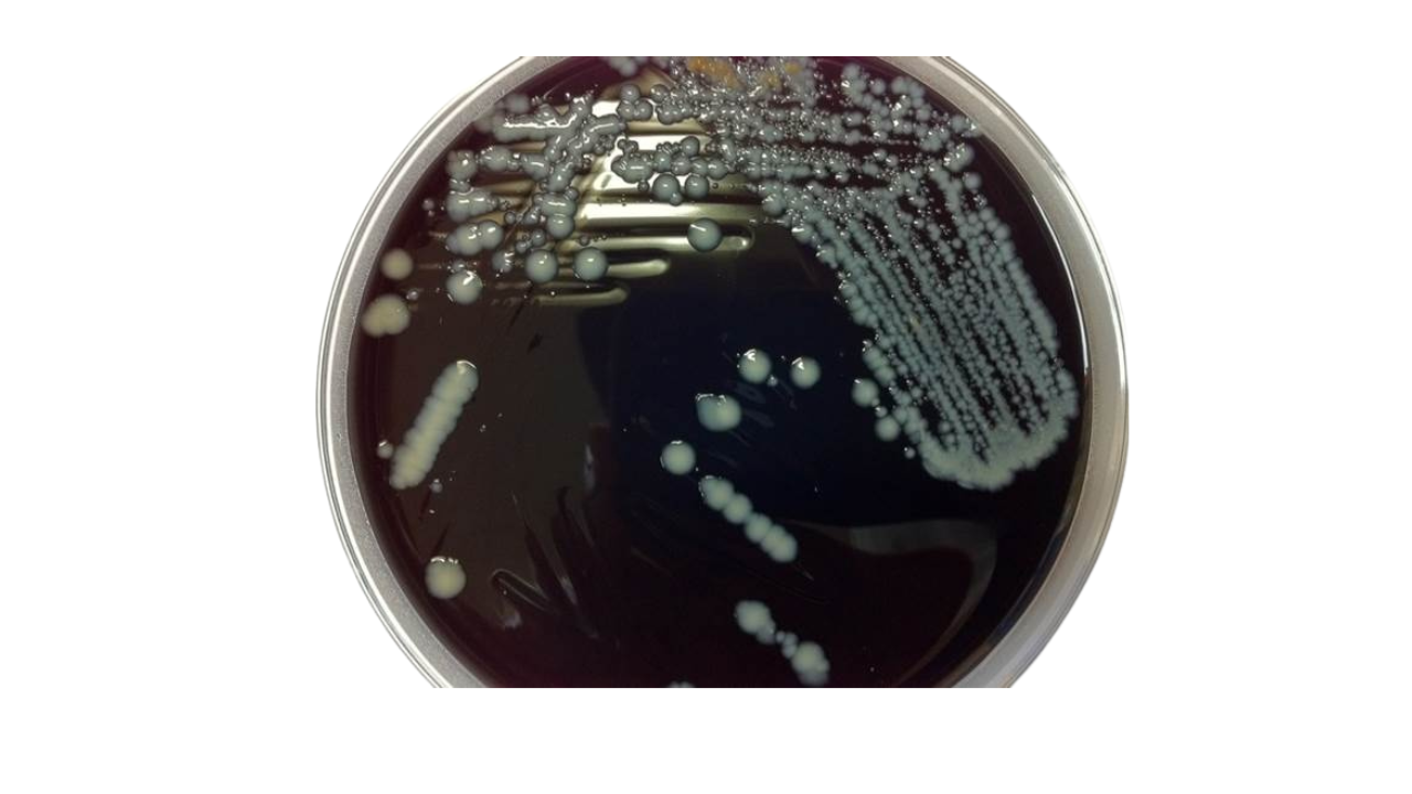 Microaerophilic /Anaerobic agar line