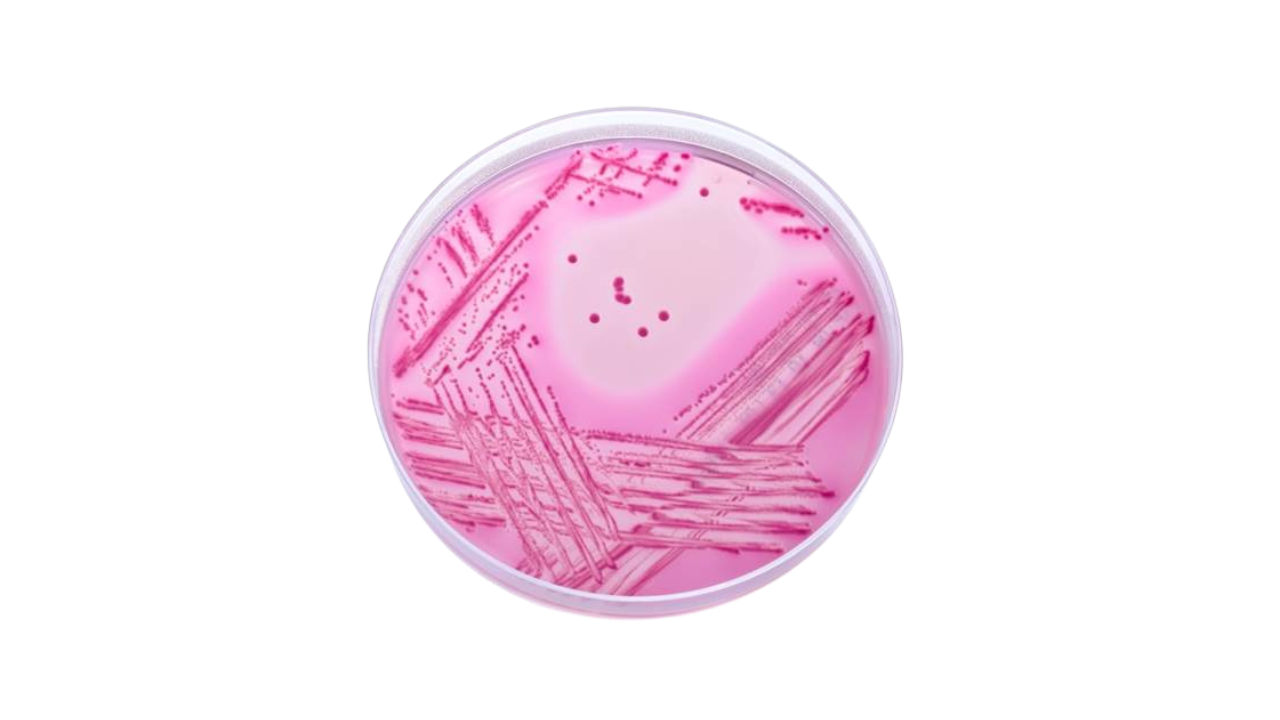 Differentiation agar line