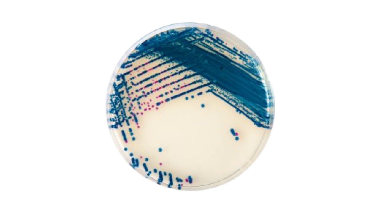 CHROMagar Strep B