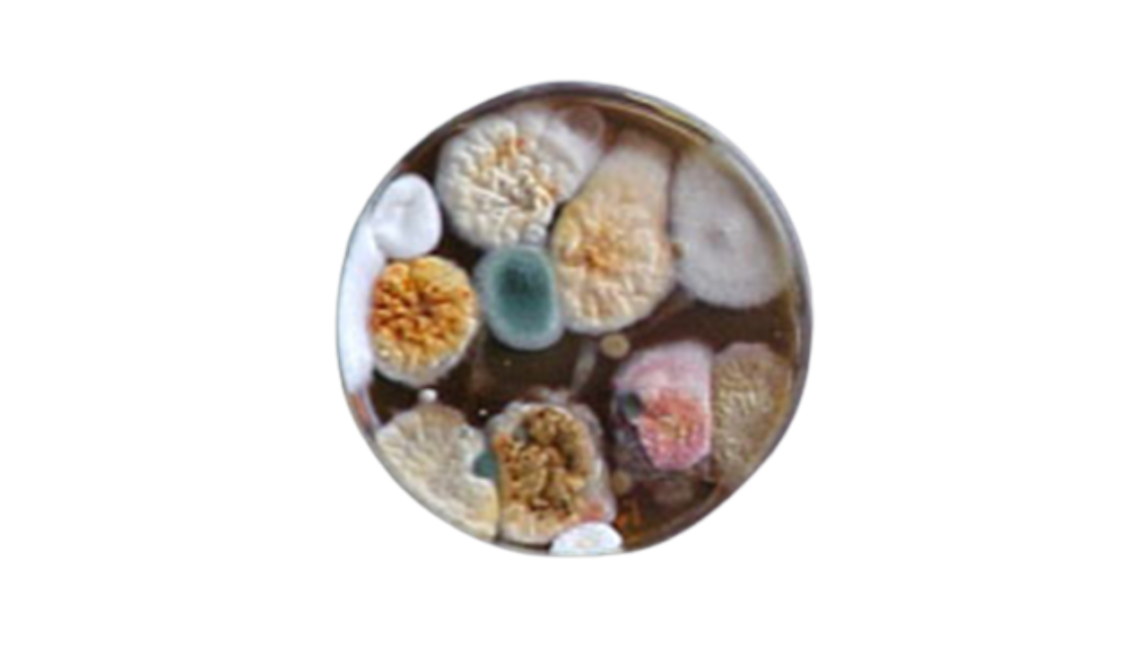 Yeast and Molds plates
