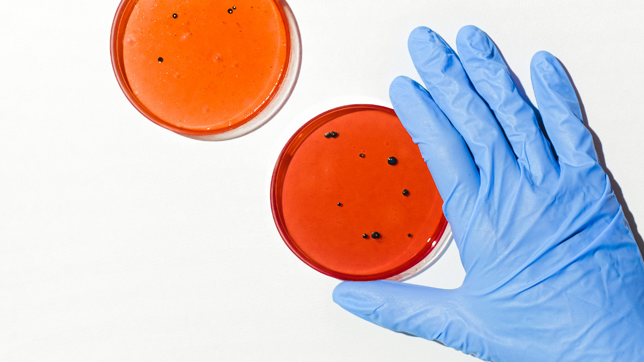 Other Microbiological tests